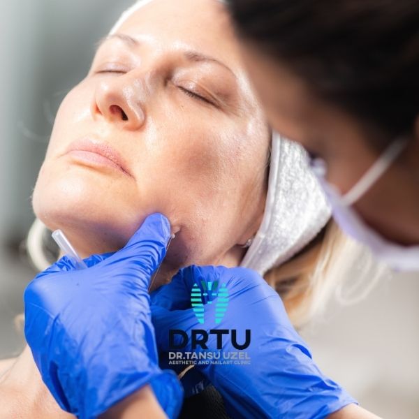masseter botoks nedir kimler icin uygulanir