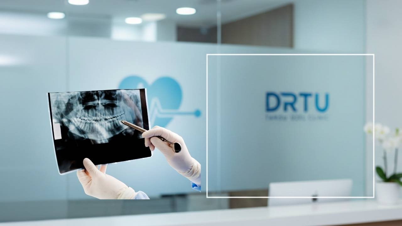 kalp hastalarinda dis agiz ve cene cerrahisi