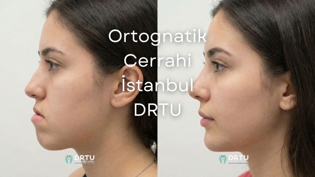 Ortognatik Cerrahi İstanbul
