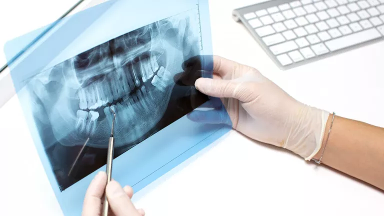 sosis teknigi ile ileri kemik eksikligi tedavisi ve implant oncesi kemik rekonstruksiyonu